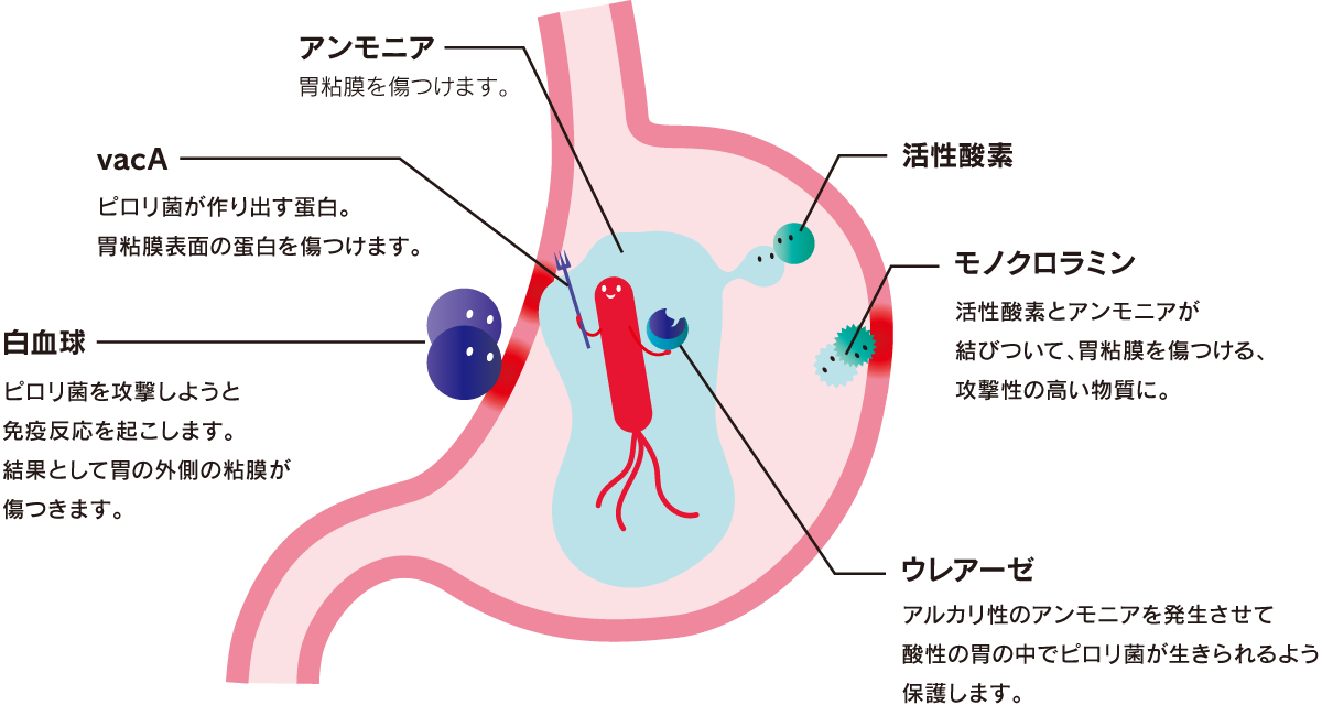 ピロリ菌とは